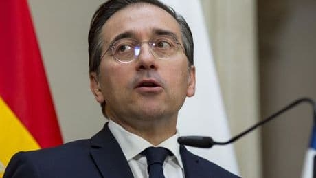Albares asegura que la Agencia Española de Cooperación está lista para enviar "todo lo necesario" a Gaza