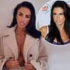 Katie Price reveals new cancer scare after finding lump in her finger - 23 years after first diagnosis