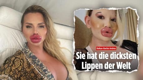 Skuriller Schnabel-Streit nach BILD-Bericht - „ICH habe die größten Lippen der Welt!“