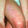 Urgent warning as Aussie state records sixth case of deadly disease this year