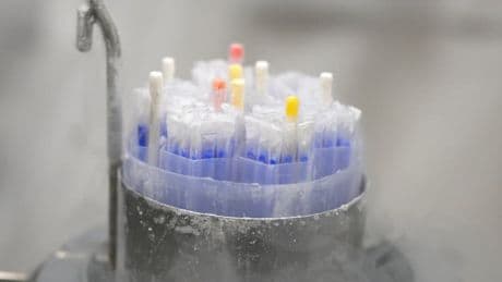 Au moins 67 enfants sont nés en Europe du don de sperme d'un homme ayant une mutation génétique prédisposant au cancer
