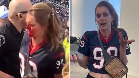 Bloodied female NFL fan speaks out and reveals she plans to SUE after violent brawl at Rams