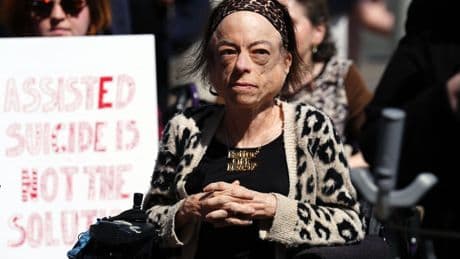 If in doubt on assisted dying, vote no, actress urges MSPs