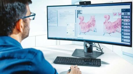 Digitale Pathologie: Vom Mikroskop zum Monitor