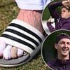 England cricketer opens up on why he almost had his toe AMPUTATED in bid to end injury hell... before doctors advised him against drastic move