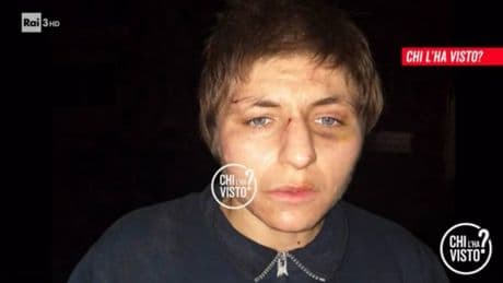 "Ustioni a forma di lettere”. L'ultimo orrore sul corpo di Marzia Capezzuti