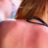 Dermatologen trekken aan de alarmbel: ‘Een aantal tieners gelooft dus eerder wat er op TikTok komt dan wat een arts zegt’