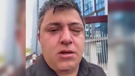 AKP'li 'belediye yöneticileri işçi darp etti' iddiası