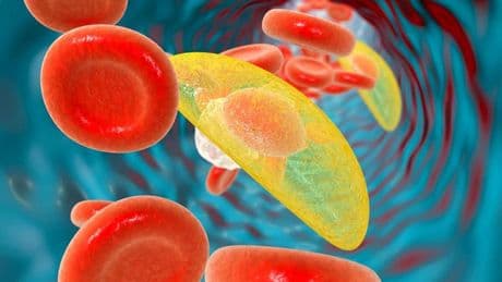 Toxoplasmosis: qué es, síntomas y tratamientos más recomendados