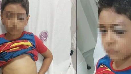 Elazığ'da oğluyla tartışan çocuğa fiziksel müdahale eden polis görevden uzaklaştırıldı