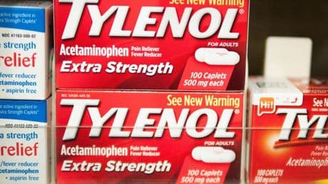 Tylenol In Pregnancy And Autism Risk. Here Are Current Recommendations
