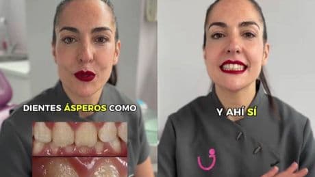Janira Sánchez, odontóloga, sobre los dientes ásperos: "Eso que notas es una gruesa capa de bacterias"