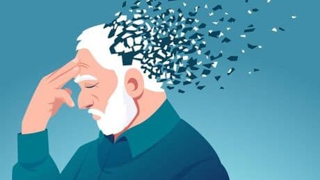 Bekannter Wirkstoff macht neue Hoffnung bei Parkinson-Demenz