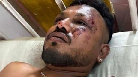 Air India survivor describes miracle escape as plane 'split and threw him out'
