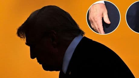 Trump sufre de insuficiencia venosa crónica, según un informe médico de la Casa Blanca