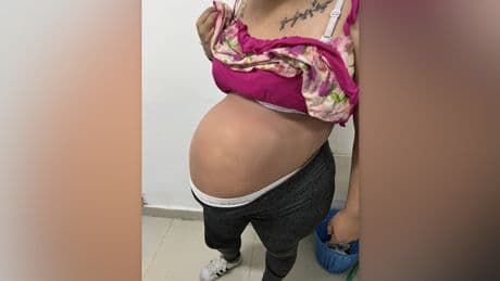 Besondere Umstände  - Frau schmuggelt Drogen im „Babybauch“