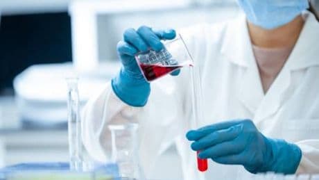 Tumori testa-collo, nuova biopsia liquida scopre la malattia nelle fasi iniziali