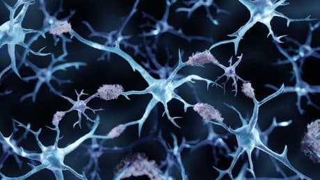 Alzheimer-Studie zeigt: Lithium-Mangel könnte möglicher Auslöser sein