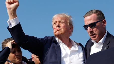 Trump was bleeding so much on the hospital bed after attempted assassination that staff thought he had been hit five times