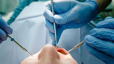 Tschechien: Falscher Zahnarzt soll illegal Patienten behandelt haben