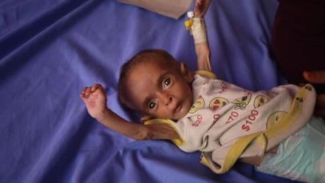 Not in Gaza: „Sie stehen kurz vor dem Hungertod“