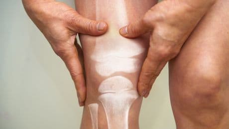 Kniearthrose: Star-Osteopath verrät, wie Sie die Schmerzen selbst lindern