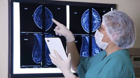 Tumore al seno, trovato anticorpo coniugato che riduce del 44% rischio morte e rallenta la malattia. Ecco come funziona