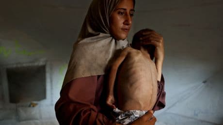 Extreme Hunger In Gaza. France To Recognize Palestinian State