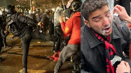GSÜ öğrencilerinden ikinci polis şiddeti raporu: "Önlemler alınsın"