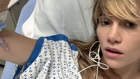Suki Waterhouse reveals she was hospitalized for hernia from wearing tight pants