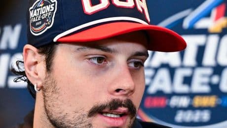 We have Auston Matthews’ health update ahead of Canada-USA 4 Nations rematch