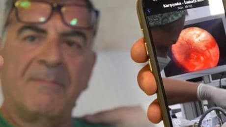 Geçmeyen öksürüğün nedeni şaşkına çevirdi! Doktorlar da şaşkın: Normal değil