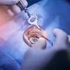 Alarming number of Lasik eye surgery patients who took their own lives revealed after police officer's suicide