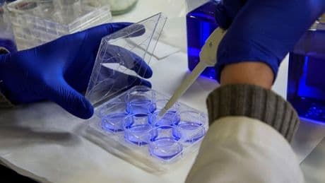 Por primera vez mueren más mujeres por cáncer de pulmón que de mama