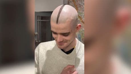 Haar-Show geht viral - Die schlimmsten Frisuren der Fußball-Stars