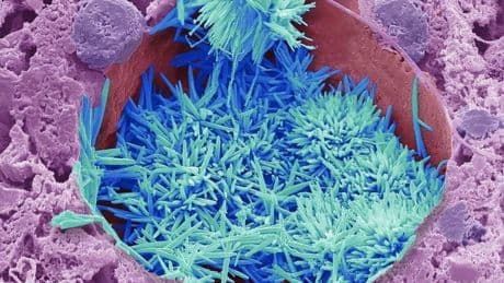 Wellcome Photography Prize Captures Topics In Science And Health
