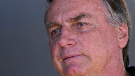 Brazilian ex-President Jair Bolsonaro is out of intensive care but still hospitalized, doctors say