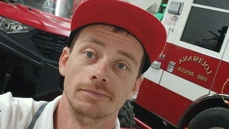 Dad left with 'half a face' after crushing own head in bulldozer horror