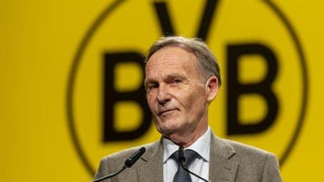 Watzke droht ein Machtkampf beim BVB