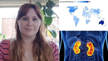 Expert reveals the six little-known signs of 'silent cancer' that is surging in under-50s