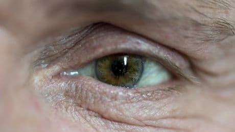 10 personnes aveugles retrouvent la vue grâce à une technique des années 1970