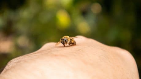 Schmerz lass nach: Diese Hausmittel helfen sofort nach einem Bienenstich