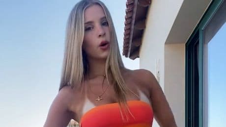 Trend oder Wahnsinn? - Bikini-Brände für Likes