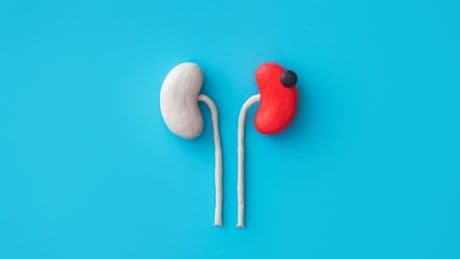 My Kidney Cancer Taught Me That Patients Aren’t Consumers