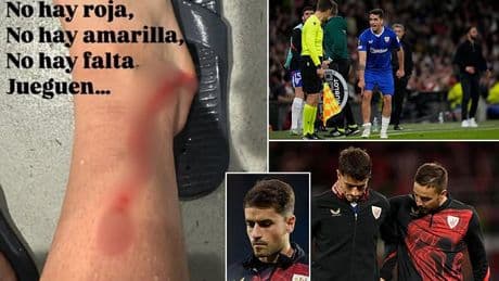 Athletic Bilbao star shows off gruesome injury after Victor Lindelof's horror tackle went unpunished in Man United clash