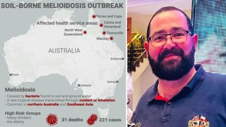 Map shows spread of tropical disease Melioidosis that has killed 31 people across Australia