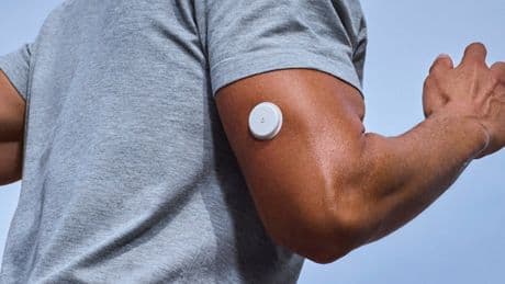 Continuous glucose monitors are in vogue. But do you really need to track your blood sugar?