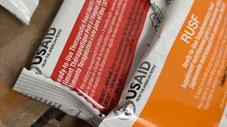 Where's Plumpy'Nut? A lifesaving food for malnourished kids is caught up in U.S. cuts