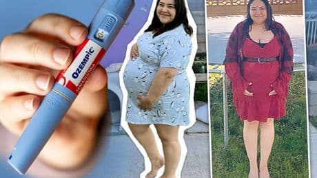 I was terrified when I got pregnant with ‘Ozempic baby’ after weeks on fat jabs – I feared ‘thalidmide effects’ or worse