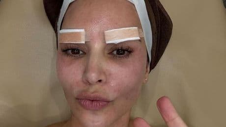 Kim Kardashian fans freak out as star undergoes bizarre beauty procedures